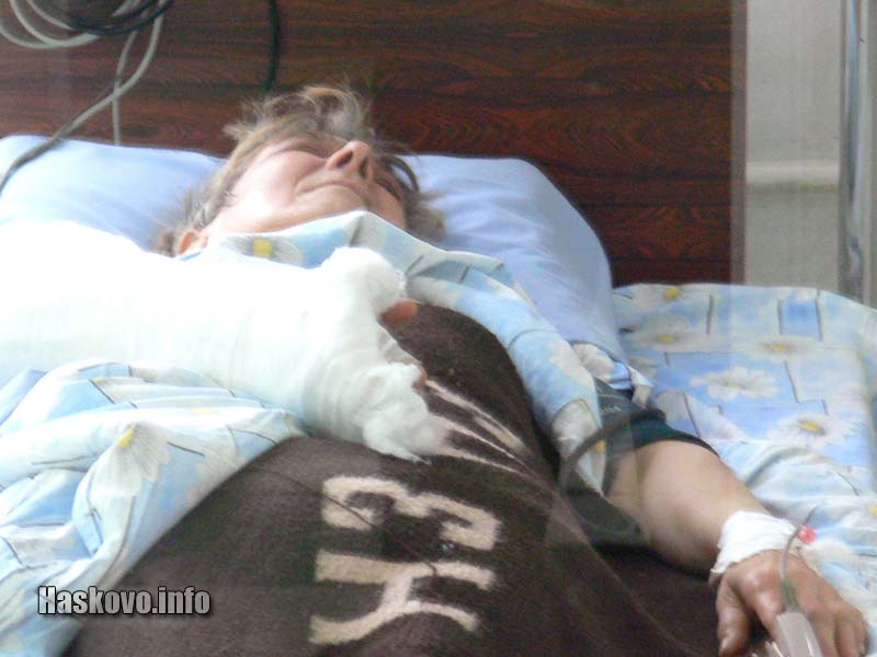 Пострадалата жена е без опасност за живота в ОАРИЛ