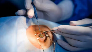 Очна хирургия