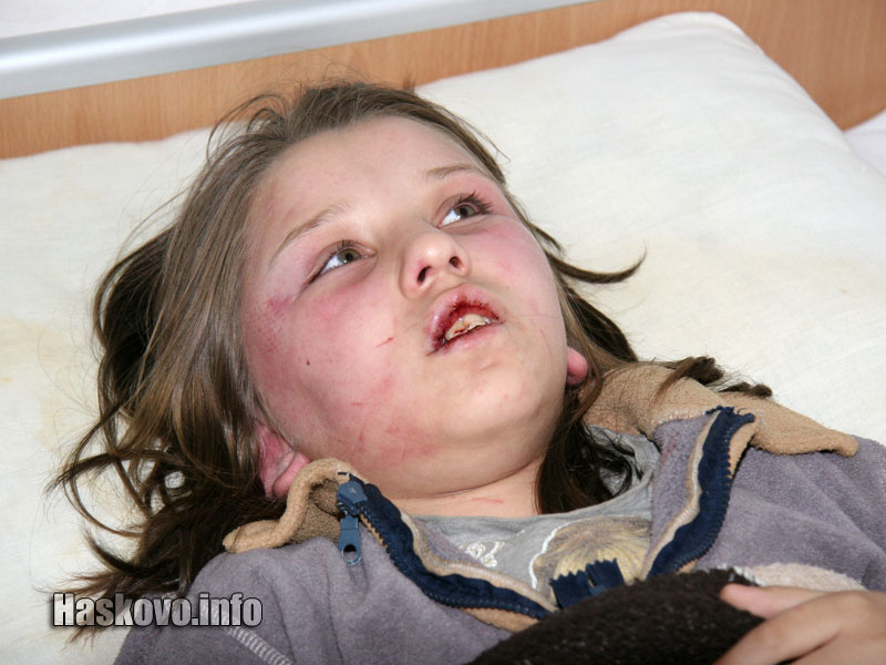 11-годишната Янка в болницата