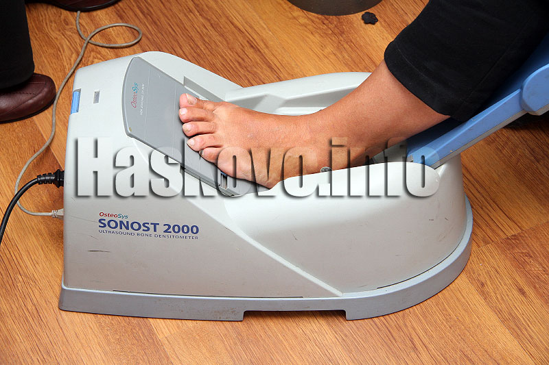 Остеопороза Остеопороза