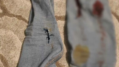 Нахапан от куче